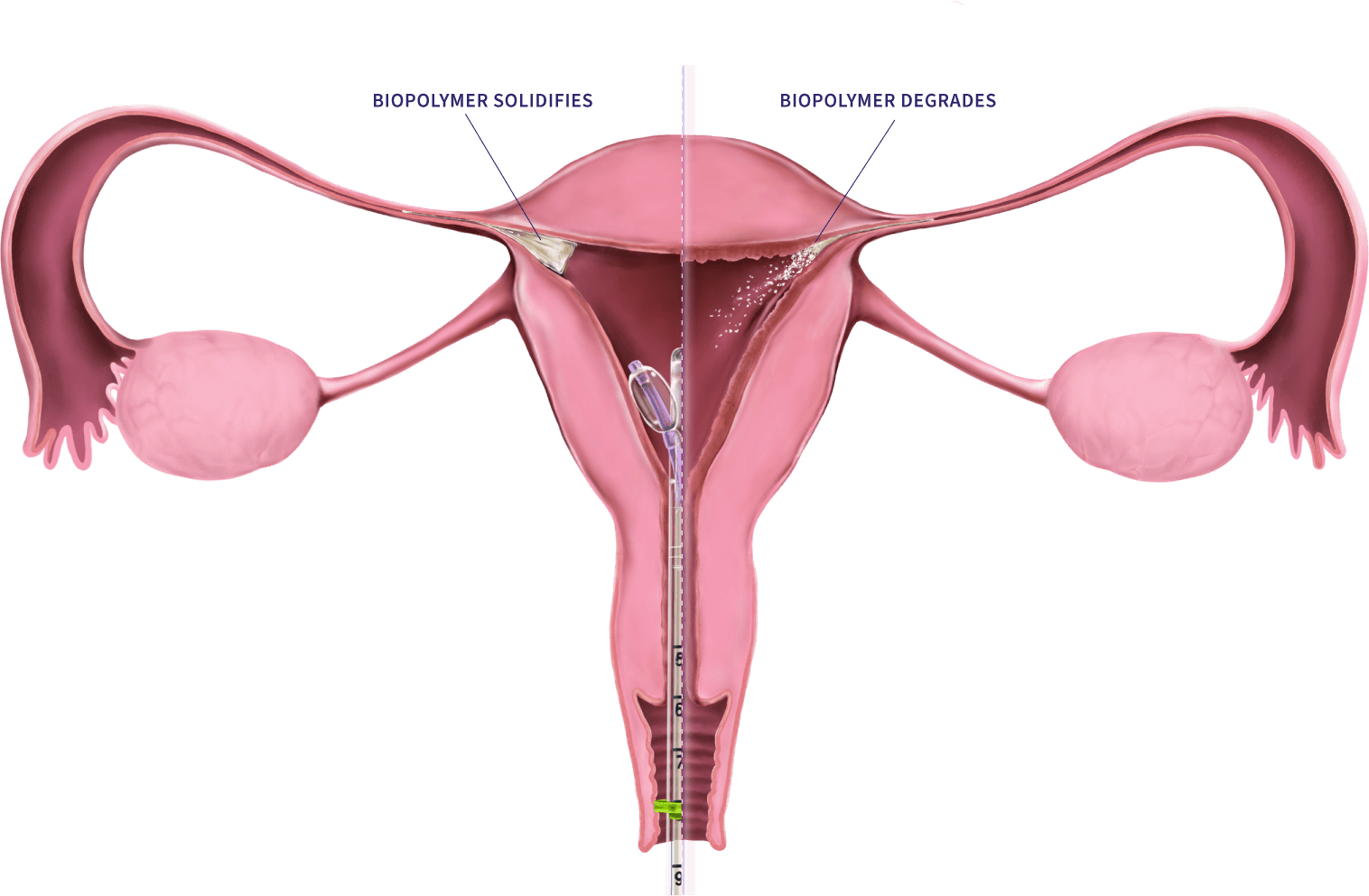 FEMBLOC diagram 1